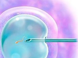 在日本做三代试管婴儿要花多少钱？