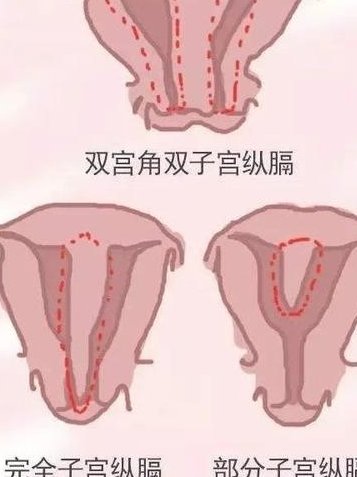 广东珠海有三代试管医院吗？广东正规三代试管医院推荐
