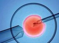 没结婚证去吉林做三代试管贵吗？费用明细是怎么样的？