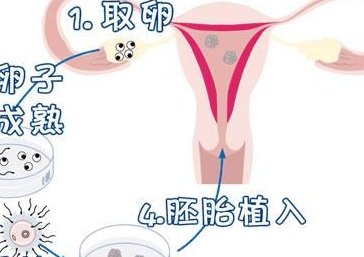 深圳第三代试管婴儿医院有几家(在深圳做试管怎么节约花费)