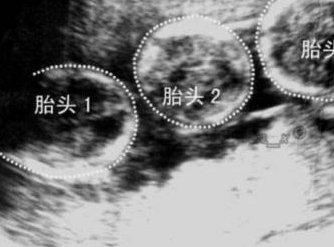 镇江助孕联系方式_镇江正规助孕公司生育服务_镇江助孕咨询